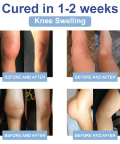 𝐉𝐨𝐫𝐨𝐧𝐝𝐲® Magnesium Pain Relief & Bone Healing Cream