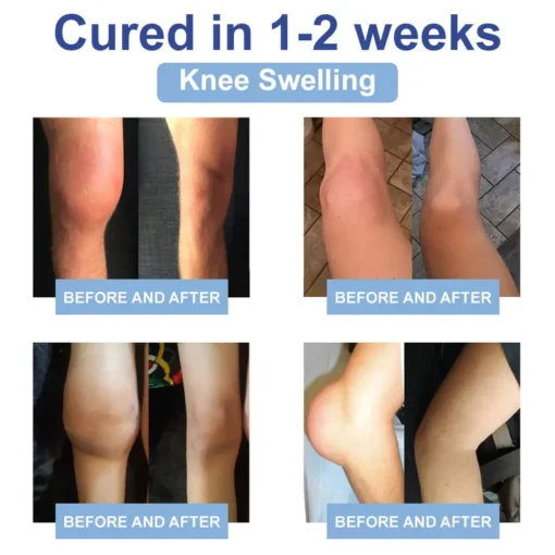 𝐉𝐨𝐫𝐨𝐧𝐝𝐲® Magnesium Pain Relief & Bone Healing Cream