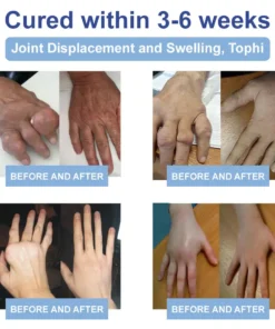 𝐉𝐨𝐫𝐨𝐧𝐝𝐲® Magnesium Pain Relief & Bone Healing Cream