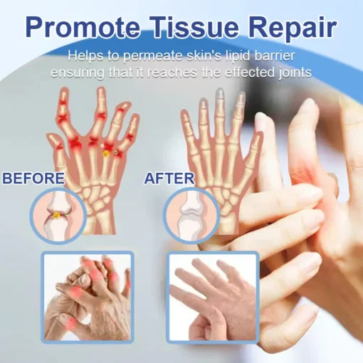 𝐉𝐨𝐫𝐨𝐧𝐝𝐲® Magnesium Pain Relief & Bone Healing Cream
