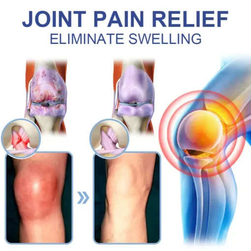 𝐉𝐨𝐫𝐨𝐧𝐝𝐲® Magnesium Pain Relief & Bone Healing Cream