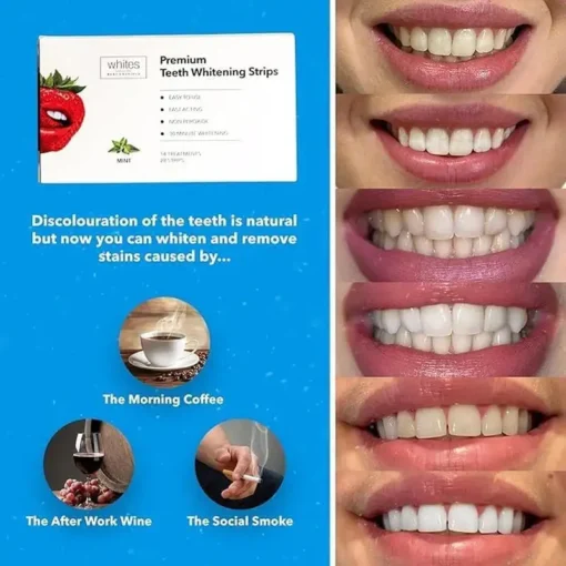 𝐉𝐨𝐫𝐨𝐧𝐝𝐲® Teeth Whitening Strips, 28 Strips (14 Day Treatment) Non Peroxide, Sensitivity Free, Vegan