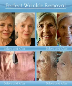 Jorondy® Anti-Wrinkle Skin Cream