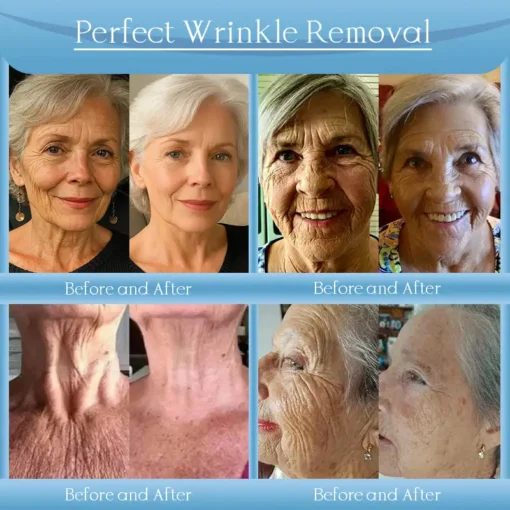 Jorondy® Anti-Wrinkle Skin Cream