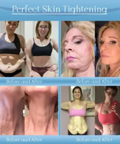 Jorondy® Anti-Wrinkle Skin Cream
