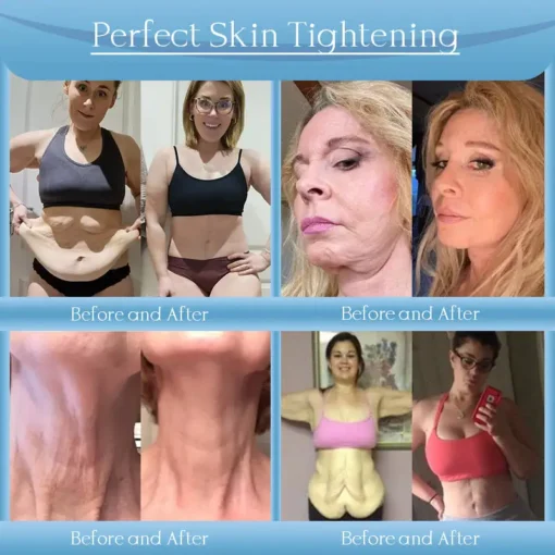 Jorondy® Anti-Wrinkle Skin Cream