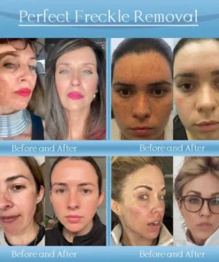 Jorondy® Anti-Wrinkle Skin Cream