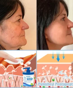 Jorondy® Anti-Wrinkle Skin Cream
