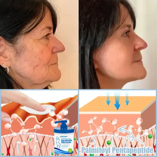 Jorondy® Anti-Wrinkle Skin Cream