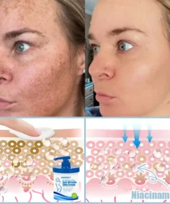 Jorondy® Anti-Wrinkle Skin Cream