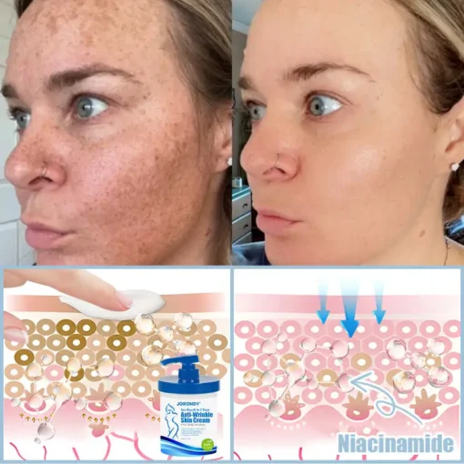 Jorondy® Anti-Wrinkle Skin Cream