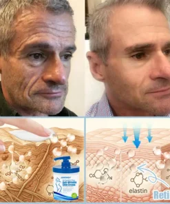 Jorondy® Anti-Wrinkle Skin Cream