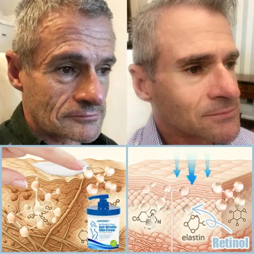 Jorondy® Anti-Wrinkle Skin Cream