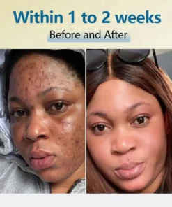 Jorondy® Bean Essence Serum