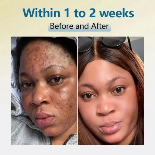 Jorondy® Bean Essence Serum