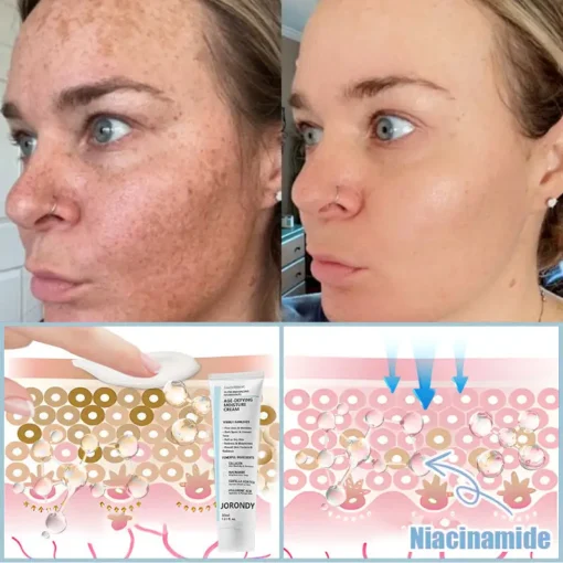 𝐉𝐨𝐫𝐨𝐧𝐝𝐲® AGE-DEFYING MOISTURE CREAM