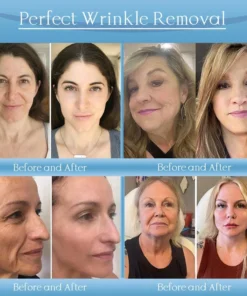 𝐉𝐨𝐫𝐨𝐧𝐝𝐲® Age-Defying Lifting Serum - Remove Wrinkles, Firms Skin, Whitening