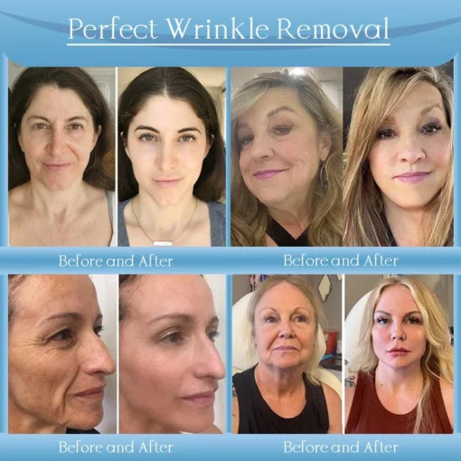 𝐉𝐨𝐫𝐨𝐧𝐝𝐲® Age-Defying Lifting Serum - Remove Wrinkles, Firms Skin, Whitening