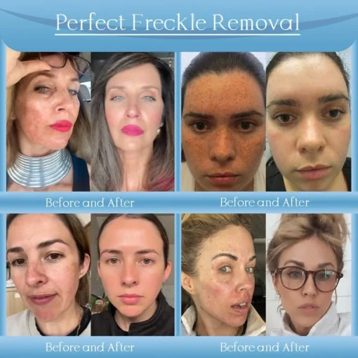 𝐉𝐨𝐫𝐨𝐧𝐝𝐲® Age-Defying Lifting Serum - Remove Wrinkles, Firms Skin, Whitening