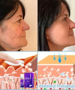 𝐉𝐨𝐫𝐨𝐧𝐝𝐲® Age-Defying Lifting Serum - Remove Wrinkles, Firms Skin, Whitening