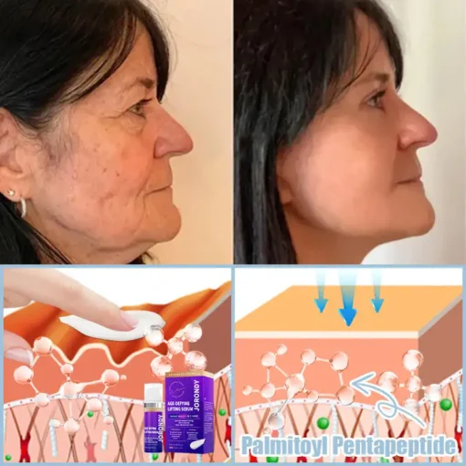𝐉𝐨𝐫𝐨𝐧𝐝𝐲® Age-Defying Lifting Serum - Remove Wrinkles, Firms Skin, Whitening