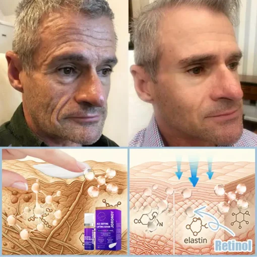 𝐉𝐨𝐫𝐨𝐧𝐝𝐲® Age-Defying Lifting Serum - Remove Wrinkles, Firms Skin, Whitening
