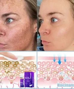 𝐉𝐨𝐫𝐨𝐧𝐝𝐲® Age-Defying Lifting Serum - Remove Wrinkles, Firms Skin, Whitening
