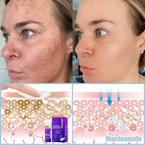 𝐉𝐨𝐫𝐨𝐧𝐝𝐲® Age-Defying Lifting Serum - Remove Wrinkles, Firms Skin, Whitening