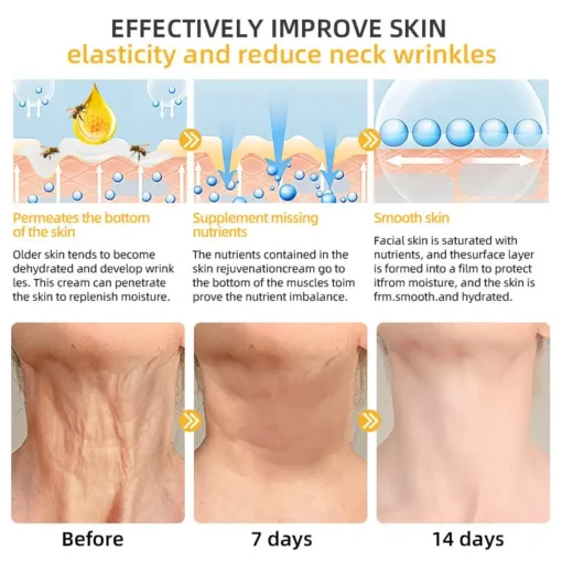 𝐉𝐨𝐫𝐨𝐧𝐝𝐲® BeeTight Anti-Aging Pro-Lifting Cream