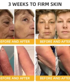 𝐉𝐨𝐫𝐨𝐧𝐝𝐲® BeeTight Anti-Aging Pro-Lifting Cream