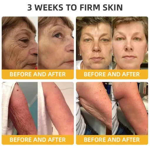 𝐉𝐨𝐫𝐨𝐧𝐝𝐲® BeeTight Anti-Aging Pro-Lifting Cream