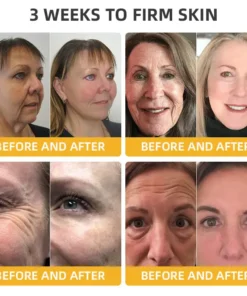 𝐉𝐨𝐫𝐨𝐧𝐝𝐲® BeeTight Anti-Aging Pro-Lifting Cream