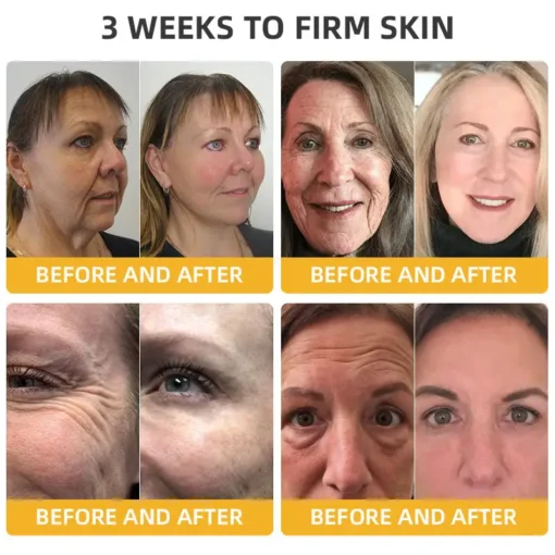 𝐉𝐨𝐫𝐨𝐧𝐝𝐲® BeeTight Anti-Aging Pro-Lifting Cream