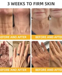 𝐉𝐨𝐫𝐨𝐧𝐝𝐲® BeeTight Anti-Aging Pro-Lifting Cream