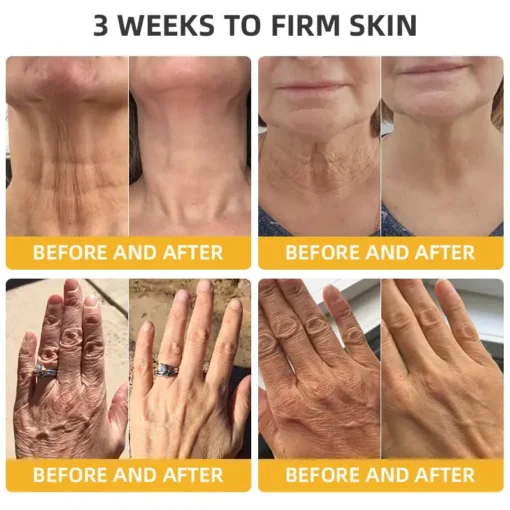𝐉𝐨𝐫𝐨𝐧𝐝𝐲® BeeTight Anti-Aging Pro-Lifting Cream