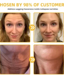𝐉𝐨𝐫𝐨𝐧𝐝𝐲® BeeTight Anti-Aging Pro-Lifting Cream