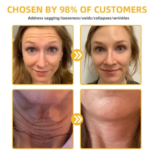 𝐉𝐨𝐫𝐨𝐧𝐝𝐲® BeeTight Anti-Aging Pro-Lifting Cream