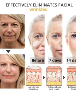 𝐉𝐨𝐫𝐨𝐧𝐝𝐲® BeeTight Anti-Aging Pro-Lifting Cream