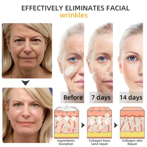 𝐉𝐨𝐫𝐨𝐧𝐝𝐲® BeeTight Anti-Aging Pro-Lifting Cream