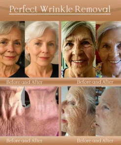𝐉𝐨𝐫𝐨𝐧𝐝𝐲® F-LIFT Anti-Wrinkle Firming Cream
