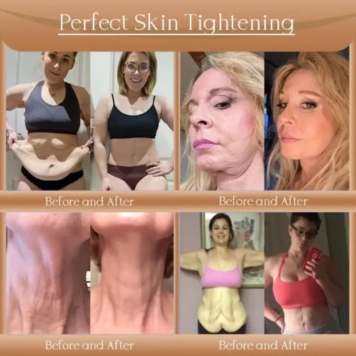 𝐉𝐨𝐫𝐨𝐧𝐝𝐲® F-LIFT Anti-Wrinkle Firming Cream