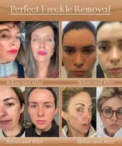 𝐉𝐨𝐫𝐨𝐧𝐝𝐲® F-LIFT Anti-Wrinkle Firming Cream