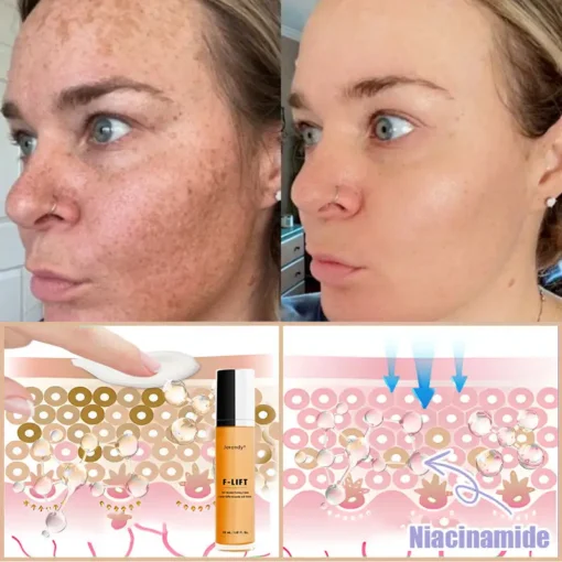𝐉𝐨𝐫𝐨𝐧𝐝𝐲® F-LIFT Anti-Wrinkle Firming Cream