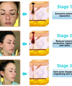 JORONDY® Exfoliating Cream for Dark Spots & Firmer Skin