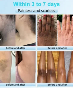 JORONDY® Exfoliating Cream for Dark Spots & Firmer Skin