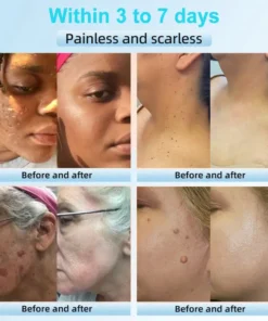 JORONDY® Exfoliating Cream for Dark Spots & Firmer Skin