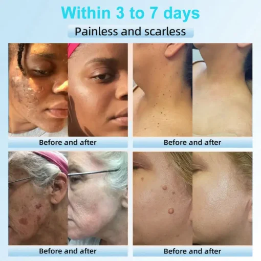 JORONDY® Exfoliating Cream for Dark Spots & Firmer Skin