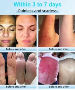 JORONDY® Exfoliating Cream for Dark Spots & Firmer Skin