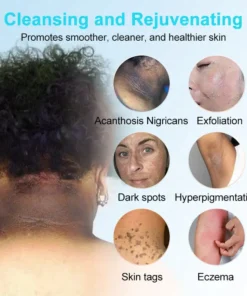 JORONDY® Exfoliating Cream for Dark Spots & Firmer Skin