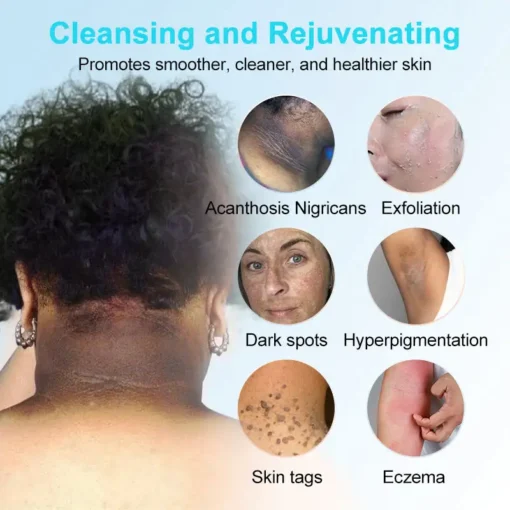 JORONDY® Exfoliating Cream for Dark Spots & Firmer Skin